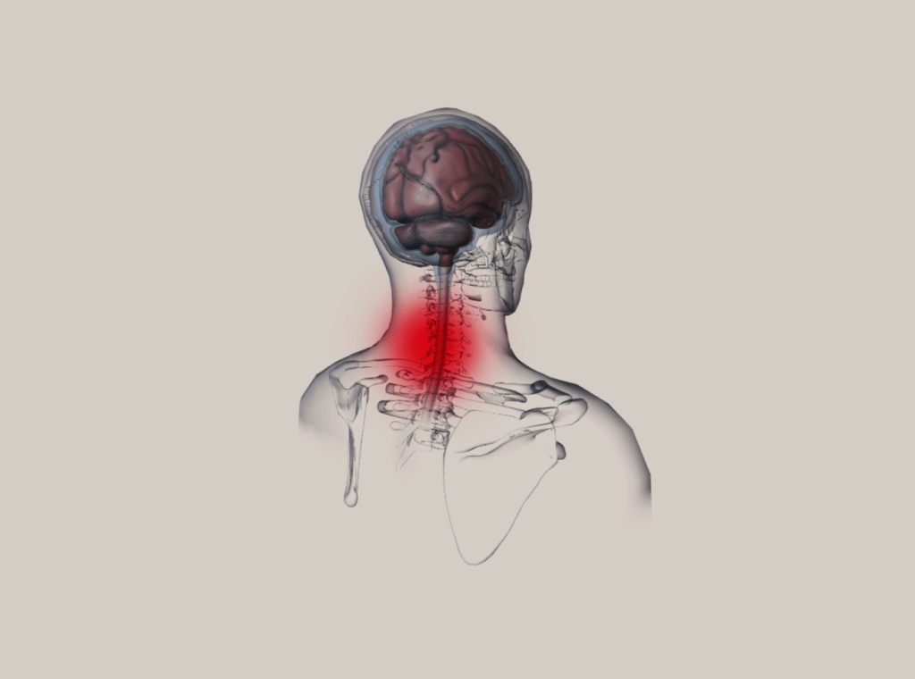 הפרעות שכיחות - כאבי שרירי צוואר-שכמה (muscle neck pain)