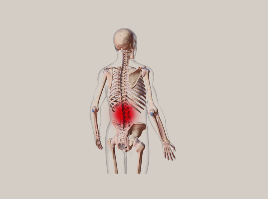 הפרעות שכיחות - כאב גב תחתון (low back pain)